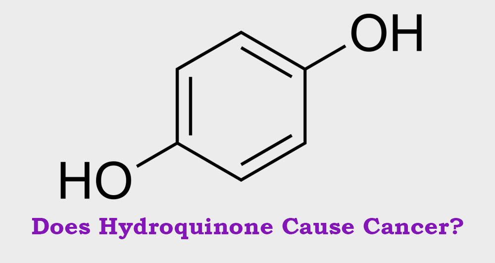 Does hydroquinone cause cancer